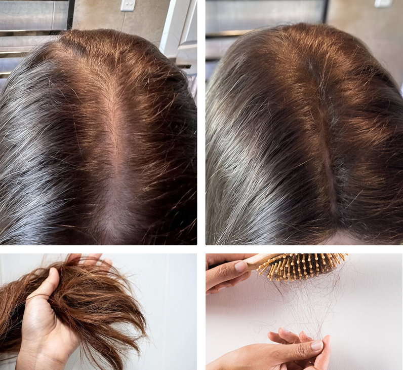 The secret weapon against hair loss: My surprising discovery
